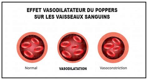 comment dilater l'anus constipation